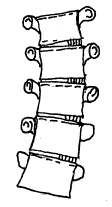 Wervelkolom-gebogen.gif